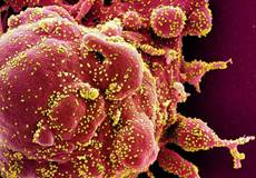 In giallo le particelle del coronavirus SarsCoV2 (fonte: NIAID) (ANSA)