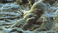 spl_t3620211-contaminated_banknote_sem