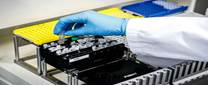 Coronavirus, speranze da farmaco anti-artrite